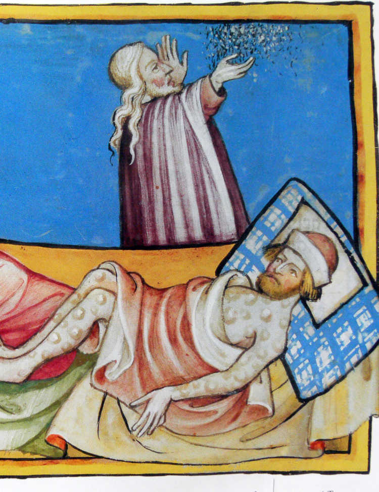 Image from Toggernberg Bible of people suffering from the sixth plague of Eygpt (boils)