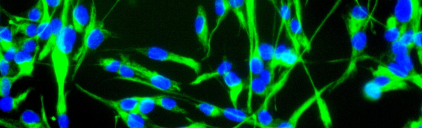 Mouse neural stem cells growing in culture. Neural stem cells can be made to develop into cells found in the central nervous system; neurons, astrocytes and oligodendrocytes.