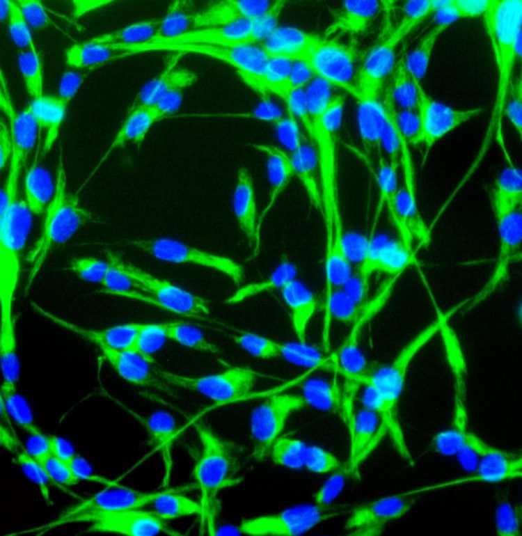 Mouse neural stem cells growing in culture. Neural stem cells can be made to develop into cells found in the central nervous system; neurons, astrocytes and oligodendrocytes.